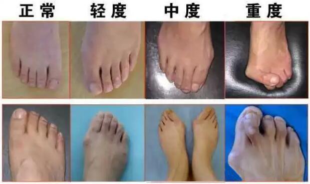 忽略了这一步 高跟鞋再贵都是浪费!