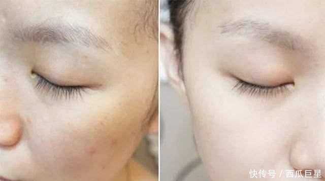 皮肤不好■淘米水中加点“它”,坚持敷脸半个月,皮肤又白又嫩,色斑都淡了