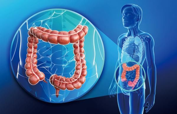 腹胀、大便带血…出现这些症状要警惕大肠癌!