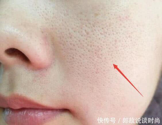 螨虫折腾你脸，4个损害的会出现，采用2招清走它！!