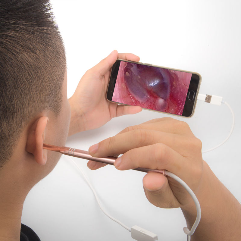 还傻傻得用棉签掏耳朵?聪明人教一招，轻轻一吸耳垢立马跑出来