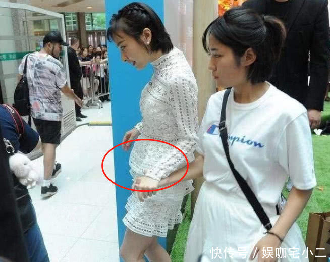 吴昕驼背穿性感短裙, 穿出来孕妇的感觉, 网友: 没有女神的仪态