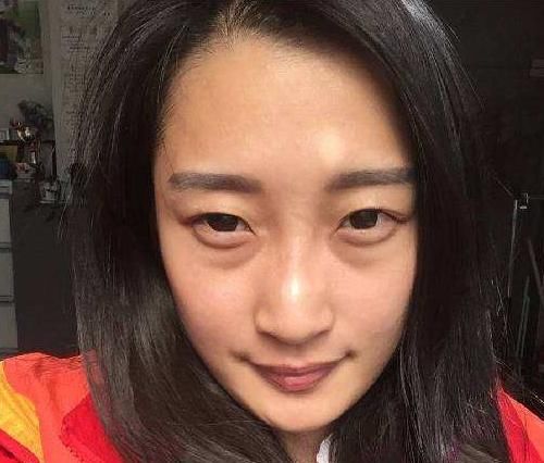  『苹果肌』脸上有这3个“特点”的人容易显老，很多人3个都占了，你中招了吗