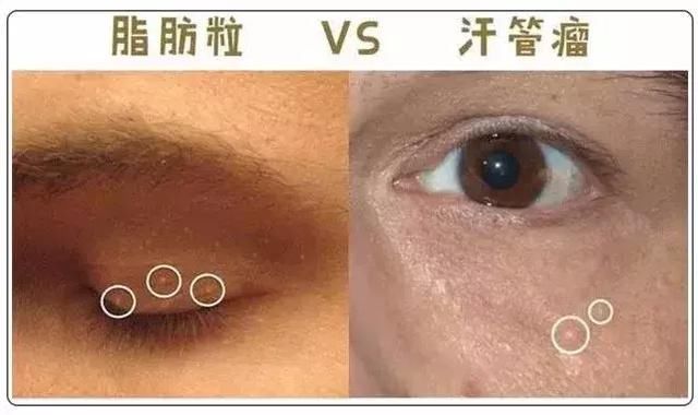 网上疯传的7条护肤谣言，是时候揭穿了！