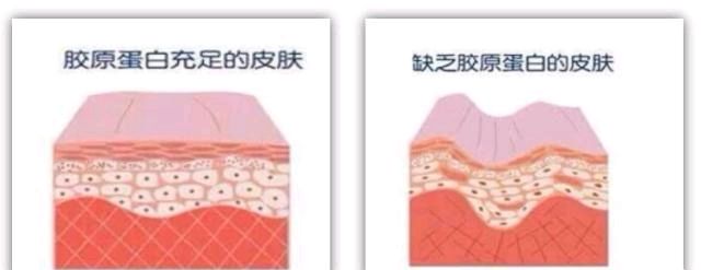  『你知道胶原』胶原蛋白真的那么重要吗？