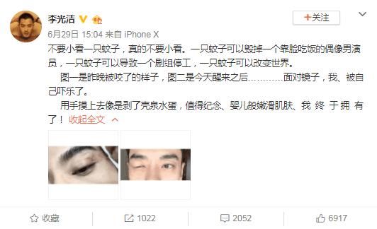 男星被蚊子咬后剧组停工，被说耍大牌，网友：蚊子咬的位置太尴尬