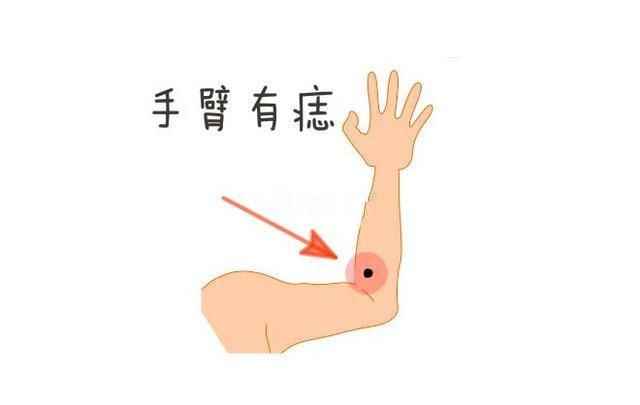 什么是恶痣什么是善痣 t01a87a37bda5e6644c.jpg