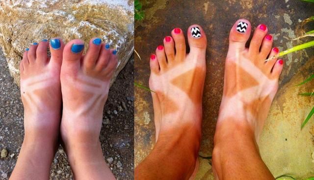 英国100年来最热夏天？别再去晒日光浴了！