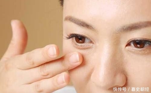 『皮肤』小细纹和表情纹有什么不同?皱纹的分类和形成原因