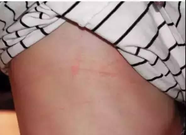 最伤乳房的行为竟是这个，再不注意就没胸了!