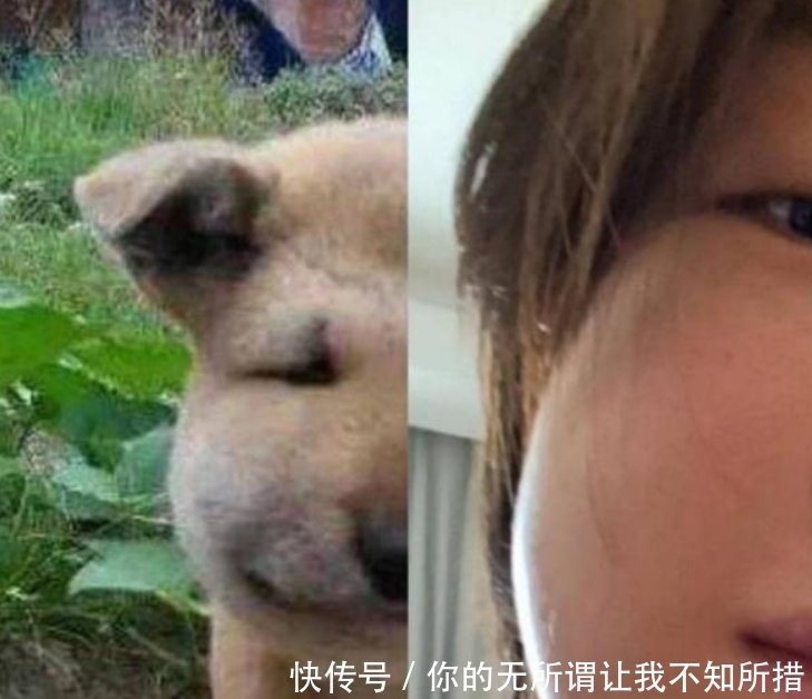 周冬雨拔智齿脸肿