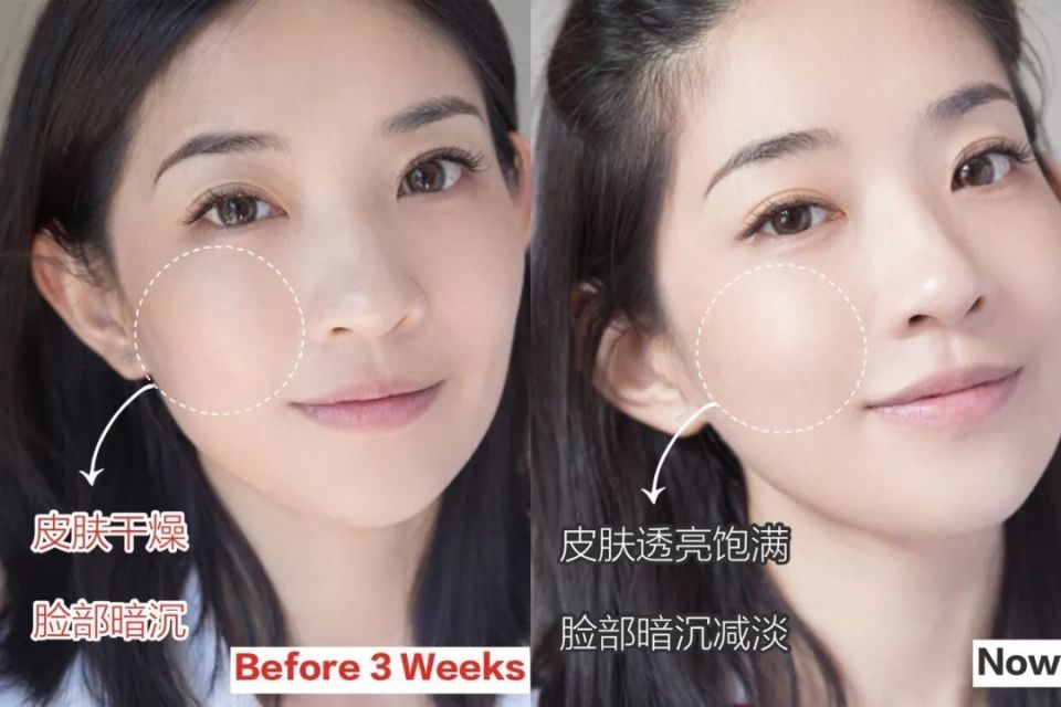 辟谣日 | 每天敷面膜、刷酸必烂脸、拍水保湿…今天你上当了吗?