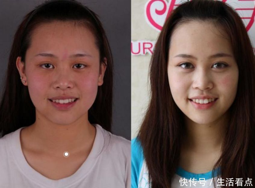 40岁的女人如何美白？只需用白醋加上“它”，皮肤白净还嫩滑！