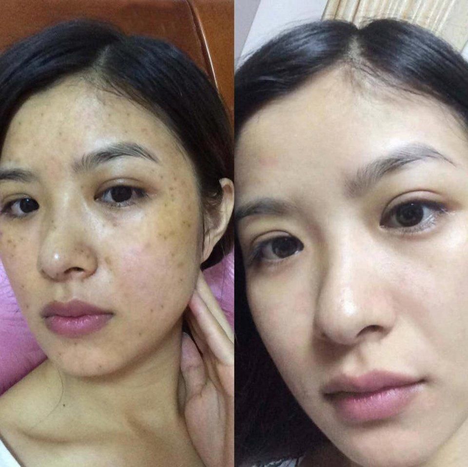 温水碰见开塞露，斑点的死敌出现了，睡前抹一下，皮肤嫩如牛奶