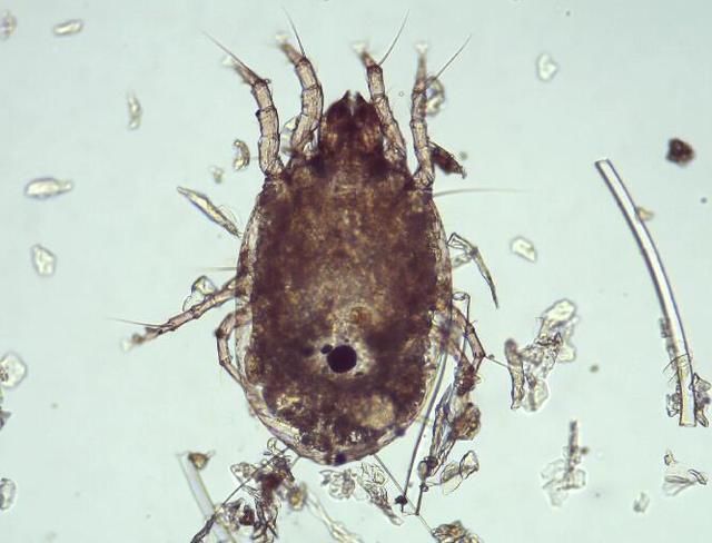 脸上有螨虫,4个问题会出现,再不除螨,脸会是你的负担