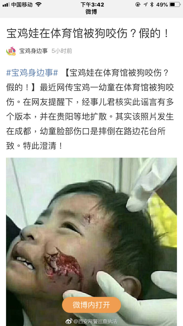 西安体育馆3岁小女孩子被狗咬半边脸?系谣言!