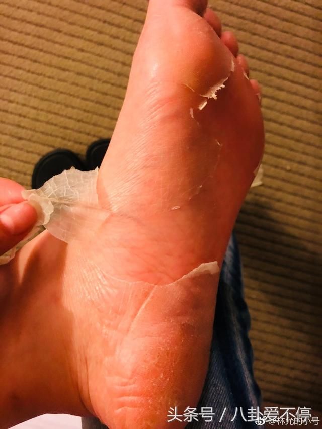 林允撕脚照片发网上，恶心还不让说，公开怼网友！学郑爽放飞自我