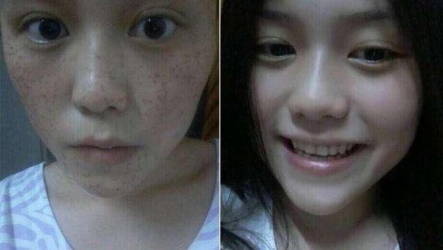 祛斑只用一滴它,老中医说睡前用它抹下脸,一夜传遍整大江南北