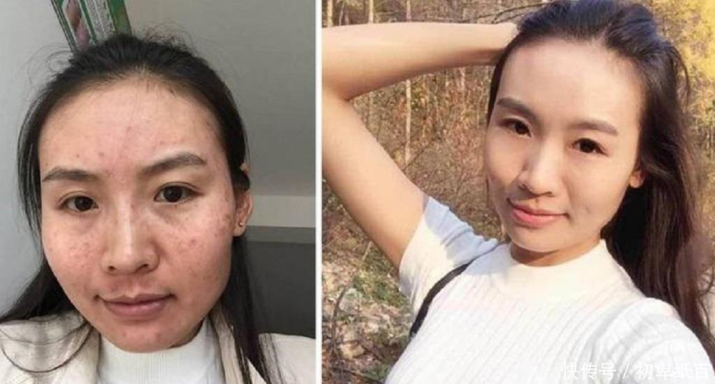 『嫩肤』土豆加“它”来敷脸,不出半个月淡化色斑又嫩肤,简单好用还省钱