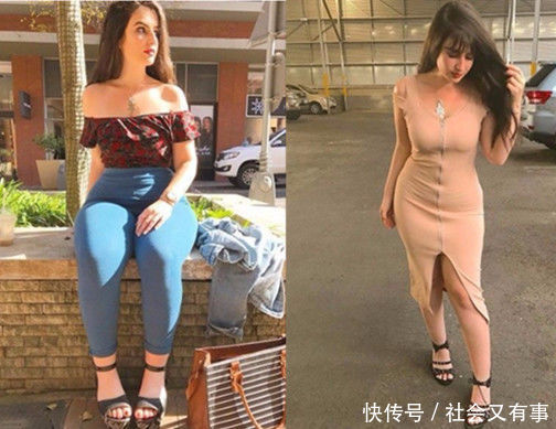 女子长着一双“大象”腿，追求者却络绎不绝，原因让人钦佩！