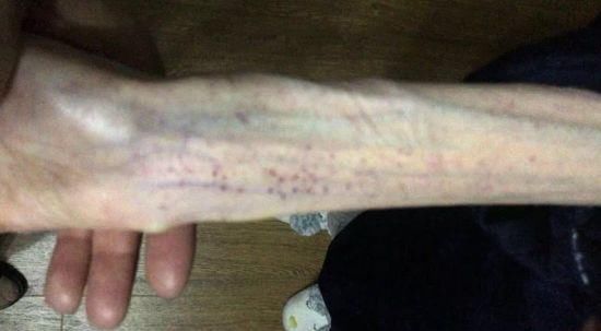 一粒米的热量都要计较，减掉60斤的她太让人心疼了…