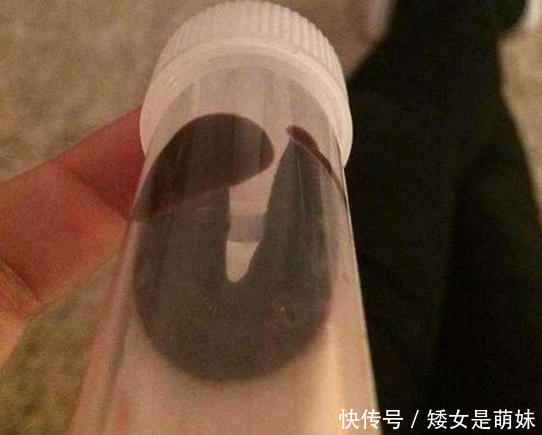 女子在原始森林洗澡,之后感到大腿内侧不舒服