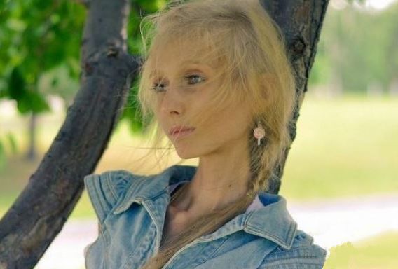 女孩为了拥有完美身材，整天靠喝水少吃饭，结果变成这副模样！