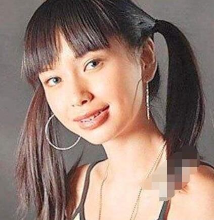 丁香医生拆台高晓松：拔牙不会让脸变小，那杨颖杨幂是怎么回事？