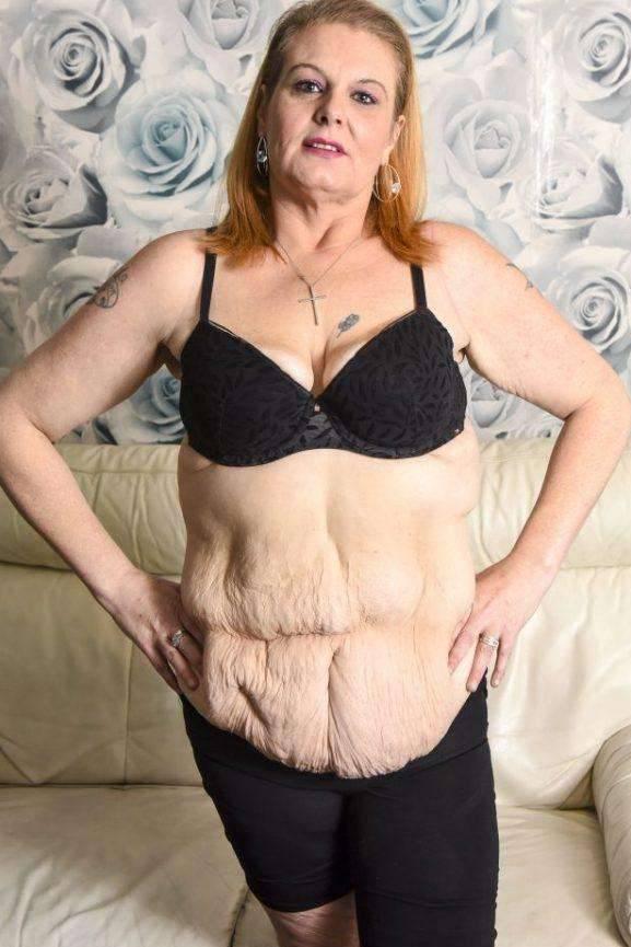 英国女子辛苦减掉150斤, 减肥后的效果却让她后悔不已