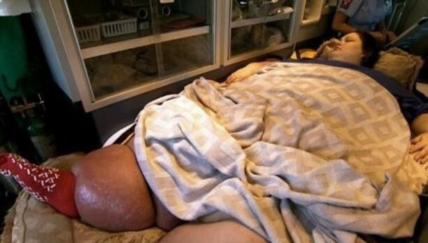 900斤胖女孩，2年成功减了600斤，减肥之后成功逆袭大美女