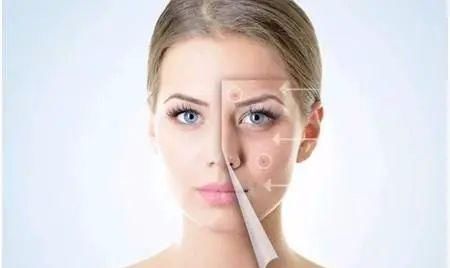  女生|女生脸上毛孔粗大怎么办，油性肌肤需要收缩毛孔的方法