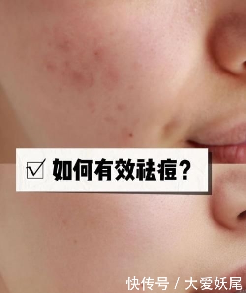 『护肤品』轻易“降低颜值”的三种护肤习惯,很多人不在意,早晚会“烂脸”