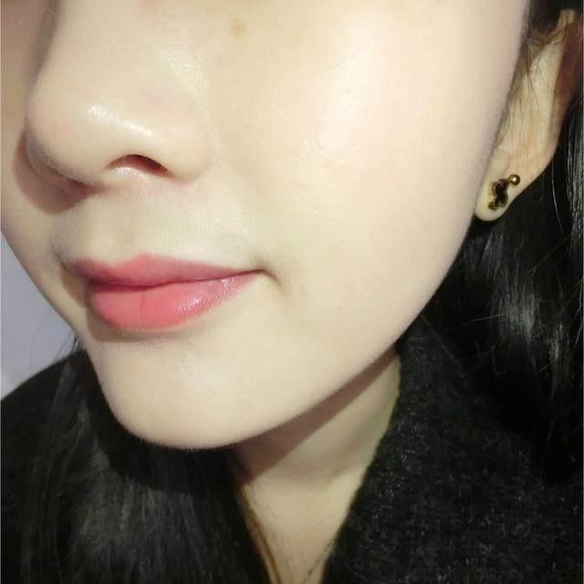 一个痘痘上竟有200条螨虫!专家教你几个小妙招