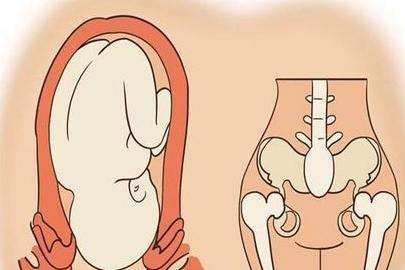 这些关于顺产的谣言，几乎所有人都中招了