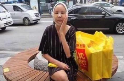 街头发现“猪头脸妹妹”,拆掉绑带以后能吓死人!