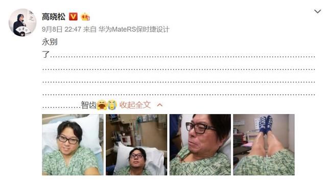 丁香医生拆台高晓松:拔牙不会让脸变小,那杨颖杨幂是怎么回事?