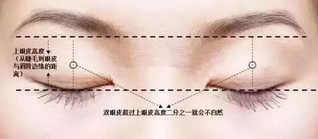  「学生妹」眼睛一单一双的学生妹，做完双眼皮竟然······