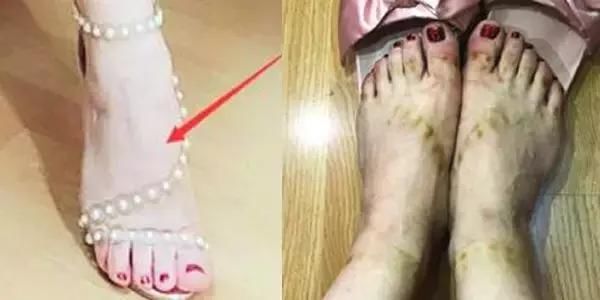看完穿高更鞋的脚，你还敢那么爱高跟鞋吗？