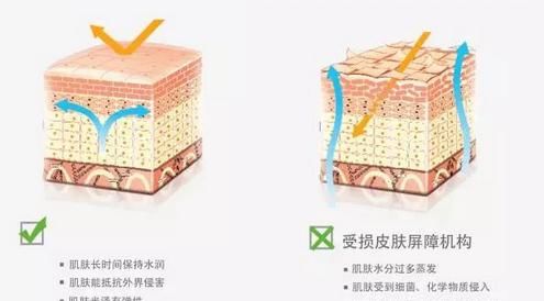  「过敏」断货王 | 柳絮敏感期50天 美少女可不能“脸红”50天啊