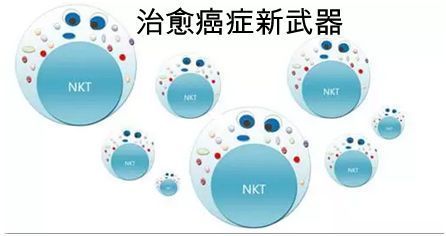 治愈癌症新武器-NKT细胞