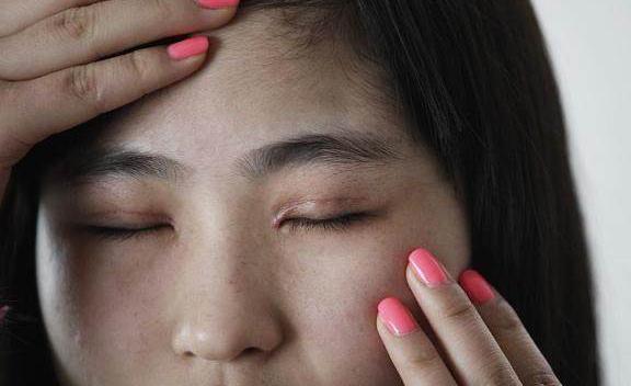 做完双眼皮的人再跟之前相比，判若两人，等到花甲之年会怎样呢?