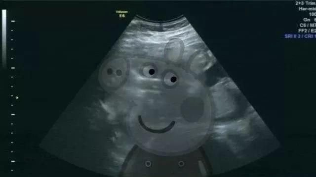 给男朋友发消息说"我好像怀孕了"，网友的评论太精彩了