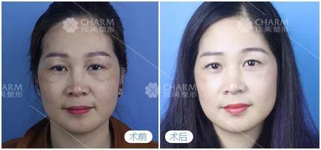 变美是一种什么样的体验?看完扎心了