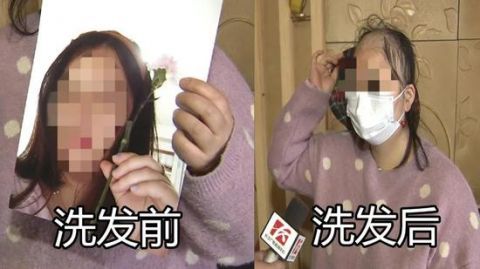  『养发』长沙女子做头发护理后变“秃头” 店家这么回应