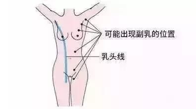 奚梦瑶 T 台走秀又崩了？这个部位不注意，夏天穿衣很尴尬