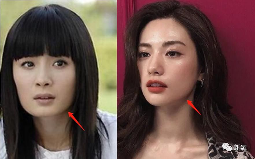  『最美脸蛋』做了不下10项整形手术，却从没脸崩过的亚洲第一美人，服气！