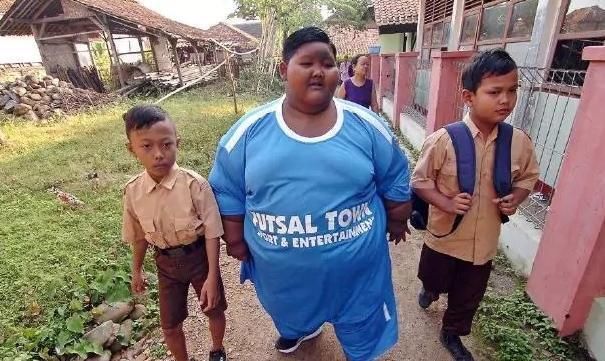 380斤！男孩儿界的吉尼斯世界纪录创造者 为减肥只有切胃