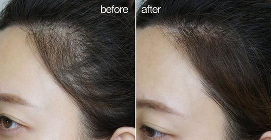 杨幂之后郑秀妍的发际线也掉线了？行走的发型教科书就这么凉凉了