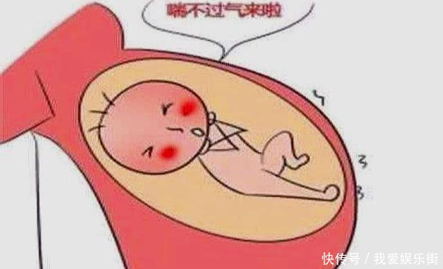 胎儿缺氧时,孕妇有什么感觉3个症状,别忽视了