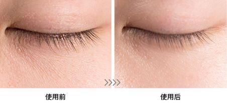 今晚早点睡永远只是自我安慰，黑眼圈早就不能再等了!